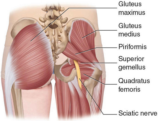 Could It Be Piriformis Syndrome?